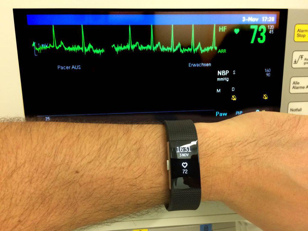 Fitbit Charge 2 Pulsmesser und EGK Vergleich Fitbit Charge 2 Pulsmesser und EGK Vergleich