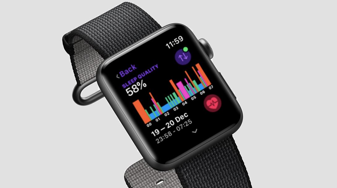 Apple Watch Series Schlaftracking Smartwatch